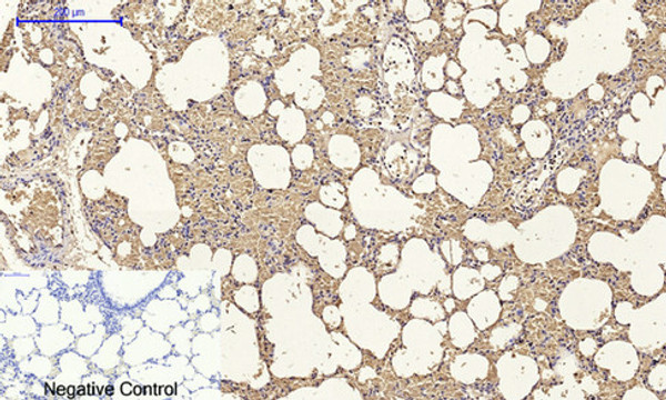 Immunohistochemical analysis of paraffin-embedded Rat-lung tissue. 1, Claudin-5 Polyclonal Antibody was diluted at 1:200 (4°C, overnight). 2, Sodium citrate pH 6.0 was used for antibody retrieval (>98°C, 20min). 3, Secondary antibody was diluted at 1:200 (room tempeRature, 30min). Negative control was used by secondary antibody only.