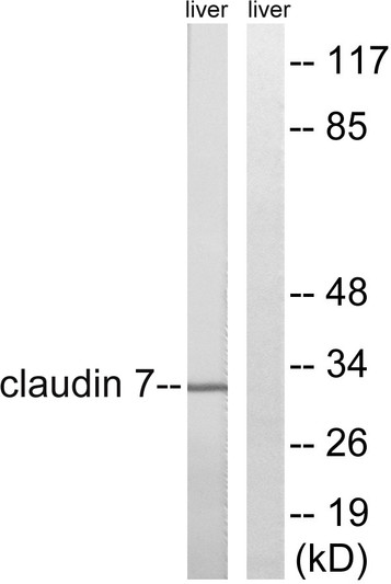 Western blot analysis of lysates from rat liver cells, using Claudin 7 Antibody. The lane on the right is blocked with the synthesized peptide.