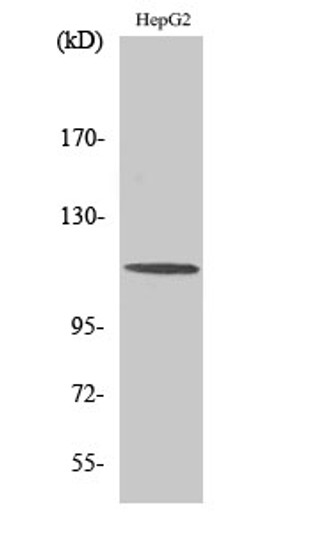 Western blot analysis of A549 cells using CLIP-115 Polyclonal Antibody