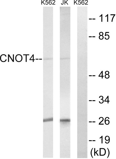 Western blot analysis of lysates from Jurkat and K562 cells, using CNOT4 Antibody. The lane on the right is blocked with the synthesized peptide.