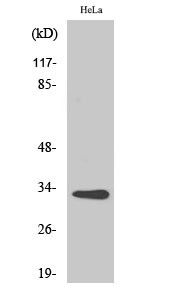 Western Blot analysis of various cells using CNOT7 Polyclonal Antibody on cells' nuclei extracted by Minute™ STJ92367