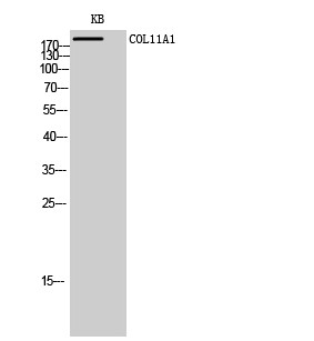 Western blot analysis of KB cells using COL11A1 polyclonal antibody diluted at 1:1000 STJ92373