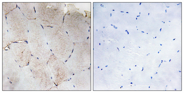 Immunohistochemistry analysis of paraffin-embedded human skeletal muscle tissue, using Collagen XII alpha1 Antibody. The picture on the right is blocked with the synthesized peptide. Immunohistochemistry analysis of paraffin-embedded human skeletal muscle tissue, using Collagen XII alpha1 Antibody. The picture on the right is blocked with the synthesized peptide.