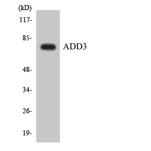 Western blot analysis of the lysates from HT-29 cells using ADD3 antibody.