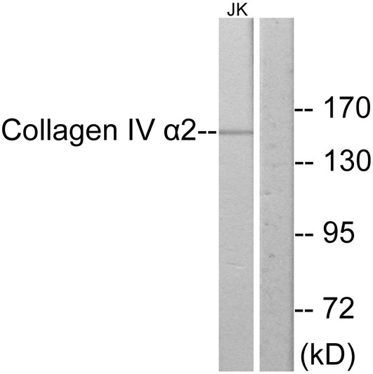 Western blot analysis of lysates from Jurkat cells, using Collagen IV alpha2 Antibody. The lane on the right is blocked with the synthesized peptide.