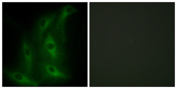 Immunofluorescence analysis of HeLa cells, using Collagen IV alpha6 Antibody. The picture on the right is blocked with the synthesized peptide.