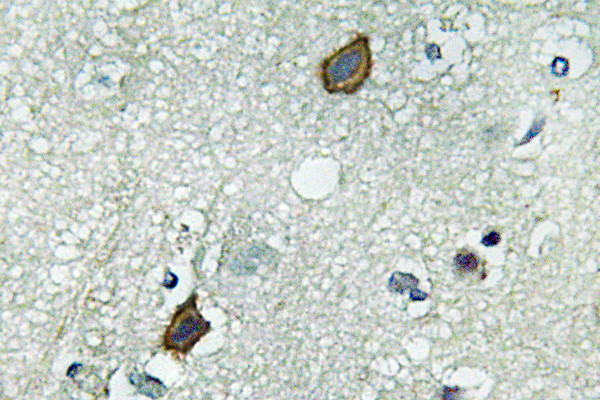 Immunohistochemistry analysis of Connexin-45 antibody in paraffin-embedded human brain tissue. Immunohistochemistry analysis of Connexin-45 antibody in paraffin-embedded human brain tissue.