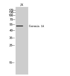 Western blot analysis of JK cells using Coronin 1A polyclonal antibody. STJ92426