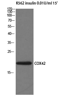 Western blot analysis of K562 insulin 0.01U/ml 15' cells using COX4I2 polyclonal antibody. STJ92440