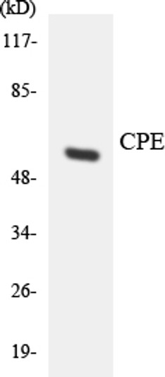 Western blot analysis of the lysates from HeLa cells using CPE antibody.