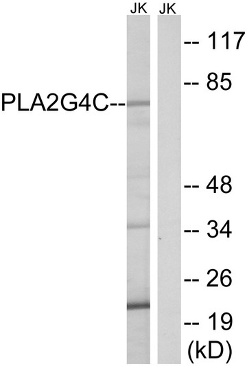 Western blot analysis of lysates from Jurkat cells, using PLA2G4C Antibody. The lane on the right is blocked with the synthesized peptide. Western blot analysis of lysates from Jurkat cells, using PLA2G4C Antibody. The lane on the right is blocked with the synthesized peptide.