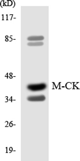Western blot analysis of the lysates from HepG2 cells using M-CK antibody. Western blot analysis of the lysates from HepG2 cells using M-CK antibody.