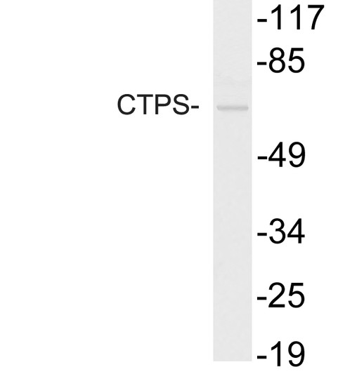 Western blot analysis of lysate from HUVEC cells, using CTPS antibody.