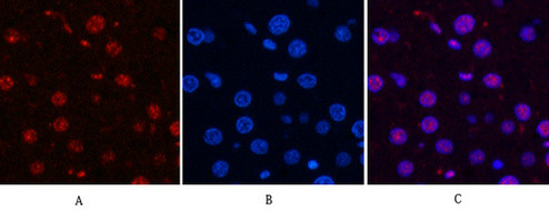 Immunofluorescence analysis of Rat-liver tissue. 1, Cyclin B1 Polyclonal Antibody (red) was diluted at 1:200 (4°C, overnight). 2, Cy3 labled Secondary antibody was diluted at 1:300 (room temperature, 50min).3, Picture B: DAPI (blue) 10min. Picture A:Target. Picture B: DAPI. Picture C: merge of A+B