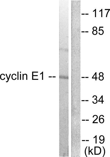 Western blot analysis of lysates from K562 cells, using Cyclin E1 Antibody. The lane on the right is blocked with the synthesized peptide.