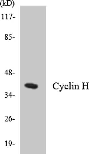 Western blot analysis of the lysates from HepG2 cells using Cyclin H antibody.