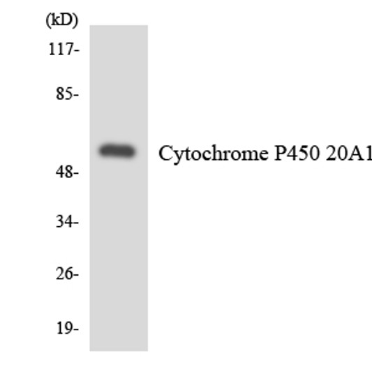 Western blot analysis of the lysates from HUVECcells using Cytochrome P450 20A1 antibody. Western blot analysis of the lysates from HUVECcells using Cytochrome P450 20A1 antibody.