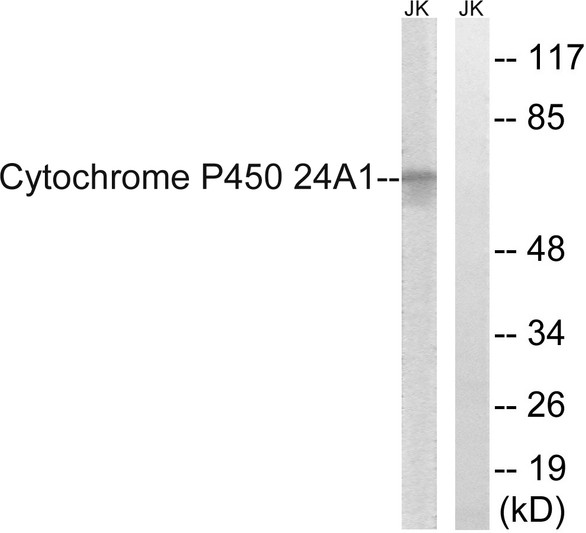 Western blot analysis of lysates from JurKat cells, using Cytochrome P450 24A1 Antibody. The lane on the right is blocked with the synthesized peptide. Western blot analysis of lysates from JurKat cells, using Cytochrome P450 24A1 Antibody. The lane on the right is blocked with the synthesized peptide.