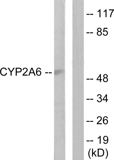 Western blot analysis of lysates from Jurkat cells, using Cytochrome P450 2A6 Antibody. The lane on the right is blocked with the synthesized peptide.