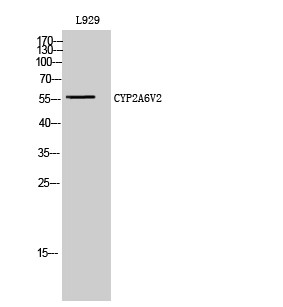 Western blot analysis of L929 cells using CYP2A6V2 polyclonal antibody diluted at 1:2000 STJ92571