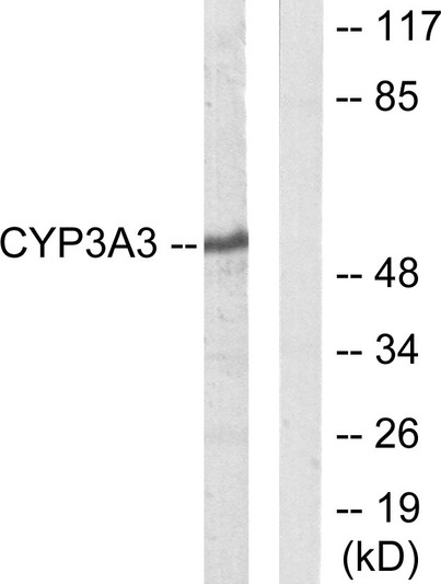 Western blot analysis of lysates from Jurkat cells, using Cytochrome P450 3A4/5 Antibody. The lane on the right is blocked with the synthesized peptide.