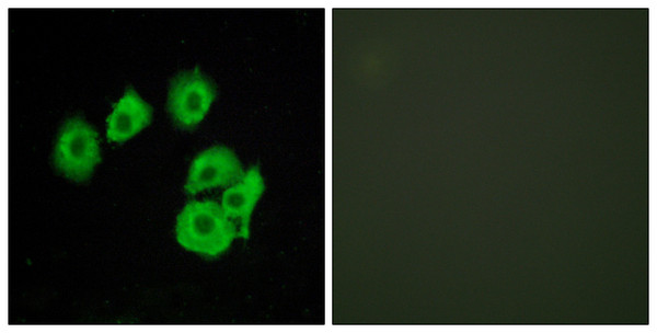 Immunofluorescence analysis of HUVEC cells, using CLTR1 Antibody. The picture on the right is blocked with the synthesized peptide.