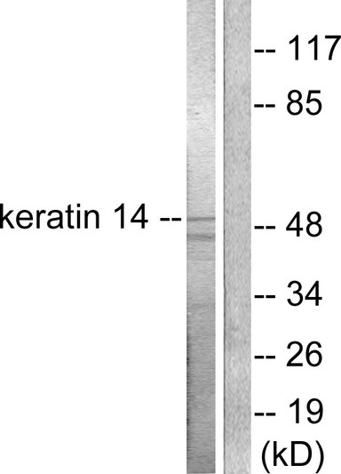 Western blot analysis of lysates from NIH/3T3 cells, using Keratin 14 Antibody. The lane on the right is blocked with the synthesized peptide.