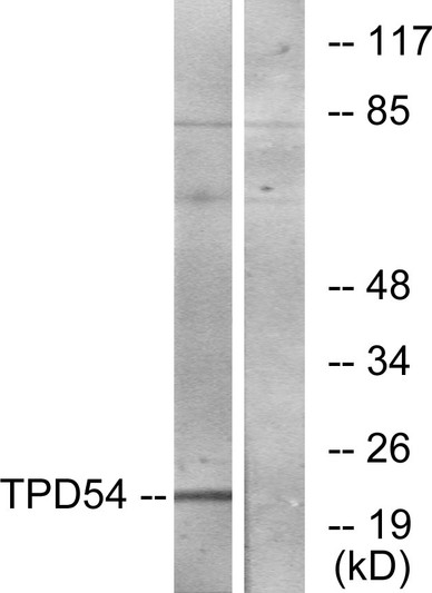 Western blot analysis of lysates from Jurkat cells, using TPD54 Antibody. The lane on the right is blocked with the synthesized peptide.