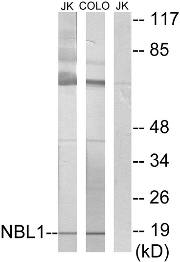 Western blot analysis of lysates from Jurkat and COLO cells, using NBL1 Antibody. The lane on the right is blocked with the synthesized peptide.