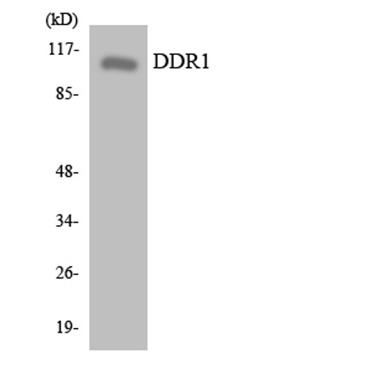 Western blot analysis of the lysates from HepG2 cells using DDR1 antibody.