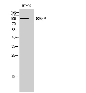 Western blot analysis of HT-29 cells using DGK-θ polyclonal antibody STJ92702