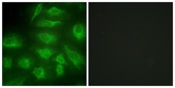 Immunofluorescence analysis of HeLa cells, using DGKI Antibody. The picture on the right is blocked with the synthesized peptide.