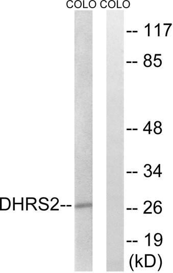 Western blot analysis of lysates from COLO cells, using DHRS2 Antibody. The lane on the right is blocked with the synthesized peptide.