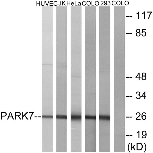 Western blot analysis of lysates from HUVEC, JurKat, HeLa, COLO205, and 293 cells, using PARK7 Antibody. The lane on the right is blocked with the synthesized peptide.