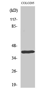 Western blot analysis of various cells using Dlx-4 polyclonal antibody, cells' nucleus extracted by Minute™ cytoplasmic STJ92724