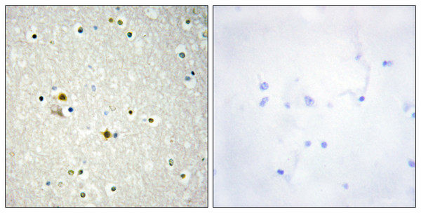 Immunohistochemistry analysis of paraffin-embedded human brain tissue, using DNL1 Antibody. The picture on the right is blocked with the synthesized peptide.
