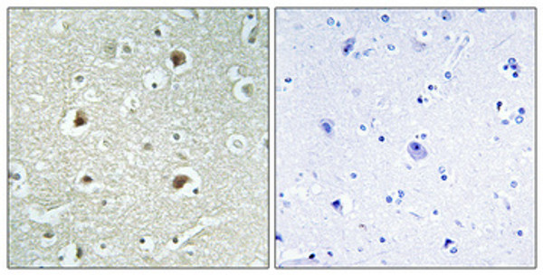 Immunohistochemical analysis of paraffin-embedded Human brain. Antibody was diluted at 1:100 (4°C overnight). High-pressure and temperature Tris-EDTA, pH8.0 was used for antigen retrieval. Negetive contrl (right) obtaned from antibody was pre-absorbed by immunogen peptide.