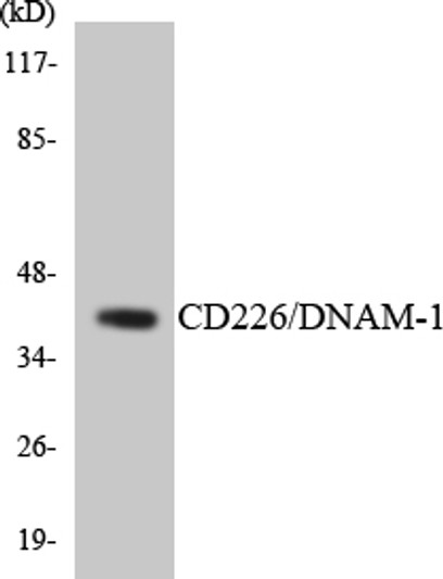 Western blot analysis of the lysates from HUVECcells using CD226/DNAM-1 antibody.