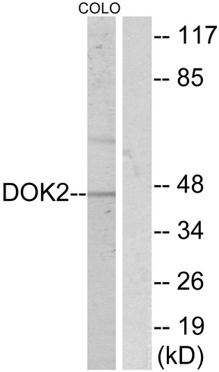 Western blot analysis of lysates from COLO205, using p56 Dok-2 Antibody. The lane on the right is blocked with the synthesized peptide. Western blot analysis of lysates from COLO205, using p56 Dok-2 Antibody. The lane on the right is blocked with the synthesized peptide.