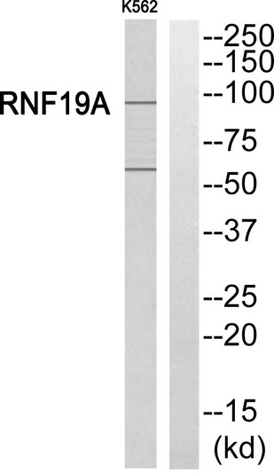 Western blot analysis of RNF19A Antibody. The lane on the right is blocked with the RNF19A peptide.