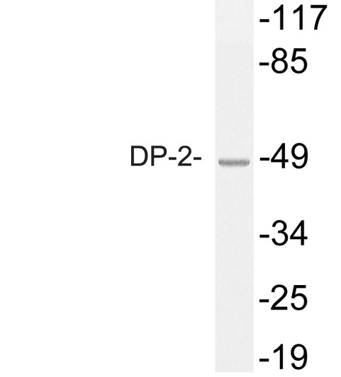 Western blot analysis of lysate from COS7 cells, using DP-2 antibody.