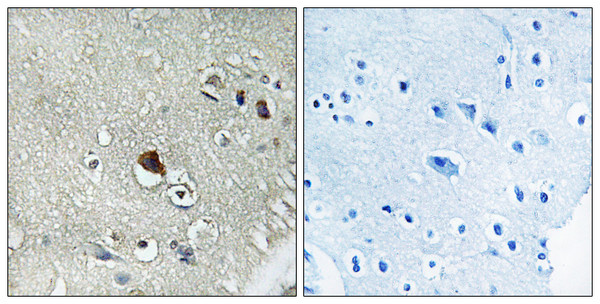 Immunohistochemistry analysis of paraffin-embedded human brain tissue, using DVL3 Antibody. The picture on the right is blocked with the synthesized peptide.
