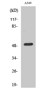Western blot analysis of various cells using Dynactin 2 polyclonal antibody diluted at 1:500 STJ92791