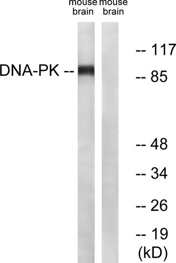 Western blot analysis of lysates from mouse brain, using Dynamin-1 Antibody. The lane on the right is blocked with the synthesized peptide.