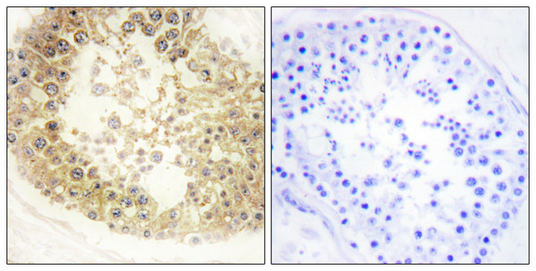 Immunohistochemistry analysis of paraffin-embedded human testis tissue, using ECRG4 Antibody. The picture on the right is blocked with the synthesized peptide.