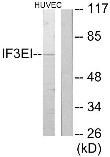 Western blot analysis of lysates from HUVEC cells, using IF3EI Antibody. The lane on the right is blocked with the synthesized peptide. Western blot analysis of lysates from HUVEC cells, using IF3EI Antibody. The lane on the right is blocked with the synthesized peptide.