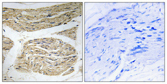 Immunohistochemical analysis of paraffin-embedded Human skeletal muscle. Antibody was diluted at 1:100 (4°C overnight). High-pressure and temperature Tris-EDTA, pH8.0 was used for antigen retrieval. Negetive contrl (right) obtaned from antibody was pre-absorbed by immunogen peptide.