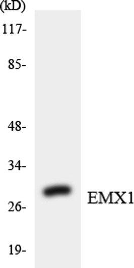 Western blot analysis of the lysates from Jurkat cells using EMX1 antibody. Western blot analysis of the lysates from Jurkat cells using EMX1 antibody.