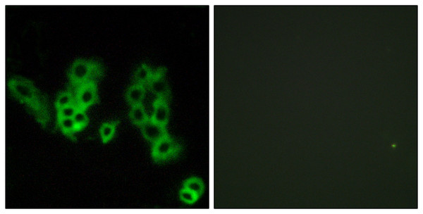 Immunofluorescence analysis of MCF7 cells, using Encephalopsin Antibody. The picture on the right is blocked with the synthesized peptide.