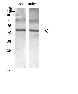 Western blot analysis of various cell lysates, antibody was diluted at 1:1000. Secondary antibody STJ92919